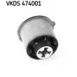 Suspension, corps de l'essieu SKF VKDS 474001 - Visuel 3