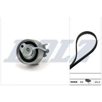 Kit de distribution DOLZ