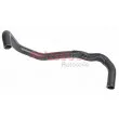 Durite de radiateur METZGER 2420369 - Visuel 1
