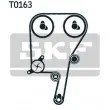 Kit de distribution SKF VKMA 06038 - Visuel 2