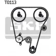 Kit de distribution SKF VKMA 06603 - Visuel 2