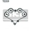 Kit de distribution SKF VKMA 92008 - Visuel 2