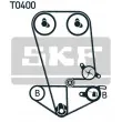Kit de distribution SKF VKMA 93014 - Visuel 2
