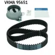Kit de distribution SKF VKMA 95651 - Visuel 1