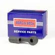 Rotule de barre de connexion BORG & BECK BTR5167 - Visuel 2