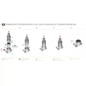 Suspension, Différentiel TEDGUM 00159940