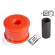 Silent bloc de suspension (train avant) TEDGUM 00397609 - Visuel 2