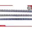 Kit de distribution par chaîne ESEN SKV 21SKV175 - Visuel 3