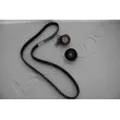 Kit de distribution RED-LINE 30CV005 - Visuel 1