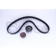 Kit de distribution RED-LINE 30MZ006 - Visuel 2