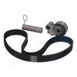 Kit de distribution ASHIKA KCT288C - Visuel 3