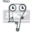 Pompe à eau + kit de courroie de distribution SKF VKMC 01121-2 - Visuel 2