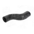 Durite de radiateur AIC 74465 - Visuel 2