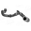 Durite de radiateur AIC 74514 - Visuel 2
